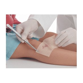 Atrauman Ointment Compress 5 x 5 cm. - 10 pcs.